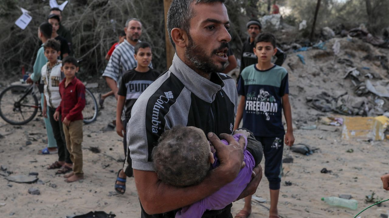 Kafası kopmuş çocukları anlatırken kelimeler boğazında düğümlendi! Gazze'den yürek yakan fotoğraflar...