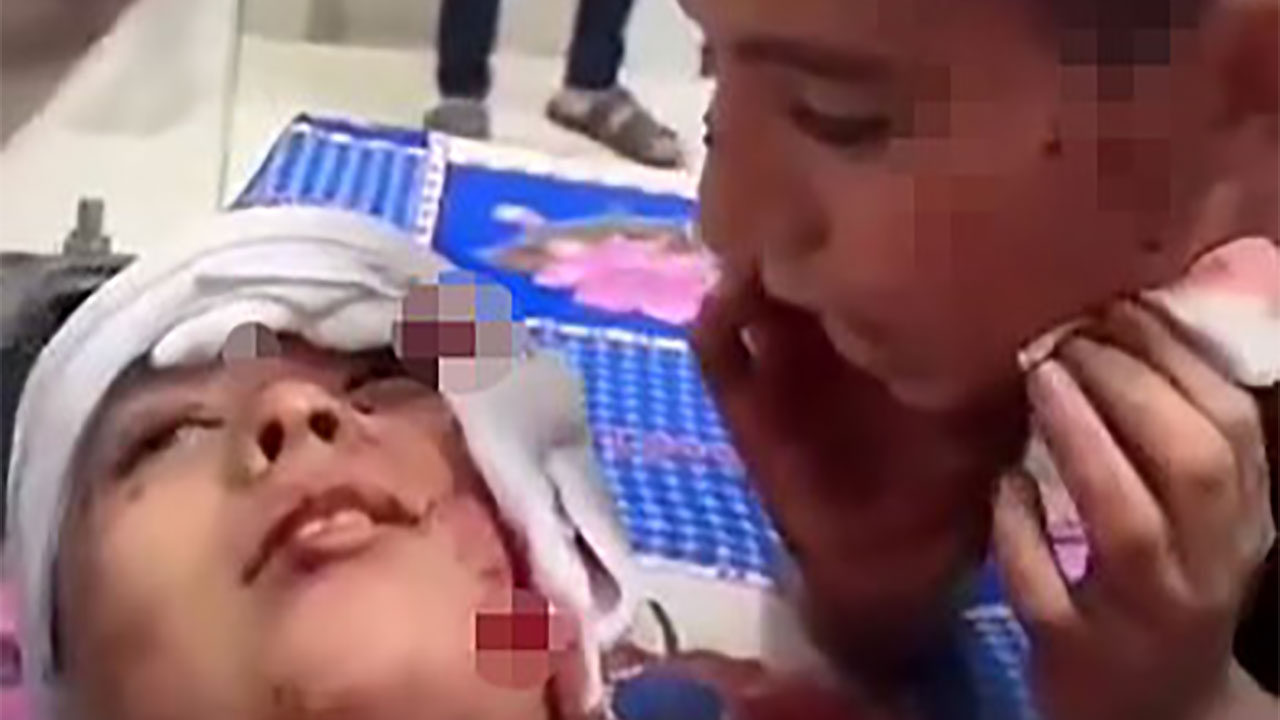 Filistinli çocuğun, yaralı kardeşinin kulağına söyledikleri yürek yaktı! Şehadet getirmeyi öğretti