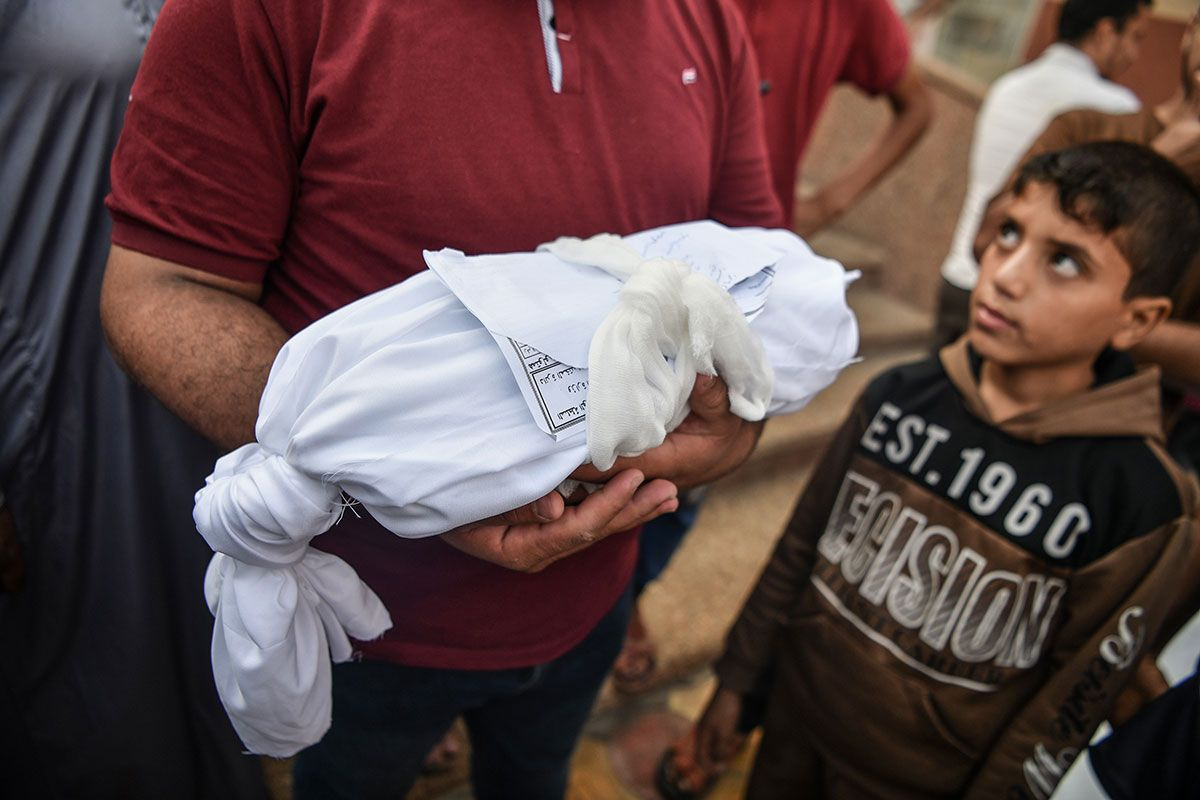 İsrail Çocuk Hastanesi'ni bombaladı! BM acı rakamları açıkladı! Ölenlerin yüzde 67'si çocuk ve kadın...