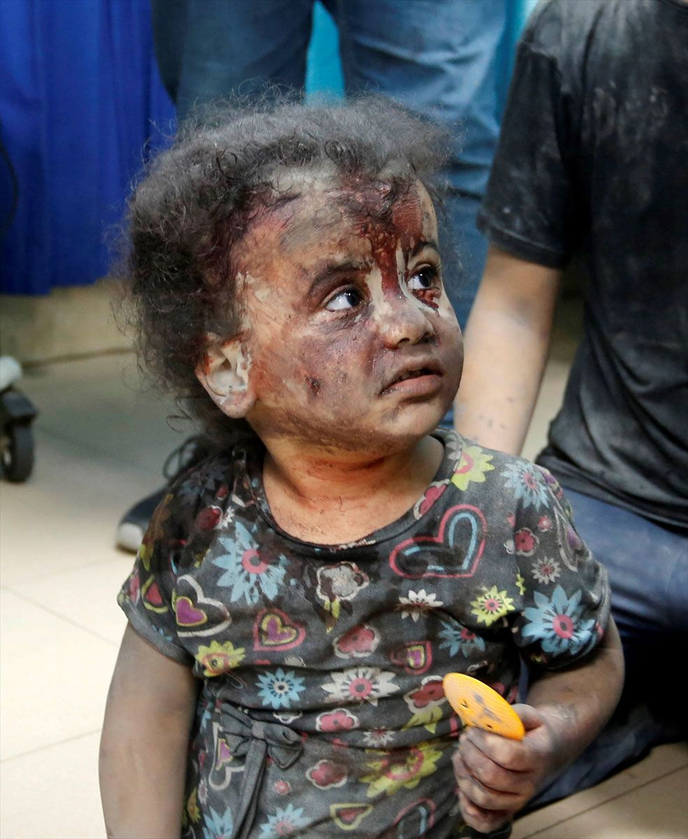 İsrail Çocuk Hastanesi'ni bombaladı! BM acı rakamları açıkladı! Ölenlerin yüzde 67'si çocuk ve kadın...