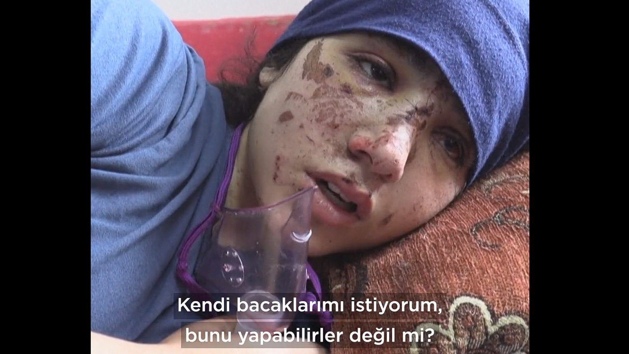 İki bacağını kaybeden Gazzeli kız yürek sızlattı! 'Gelecek diye bir şey yok'