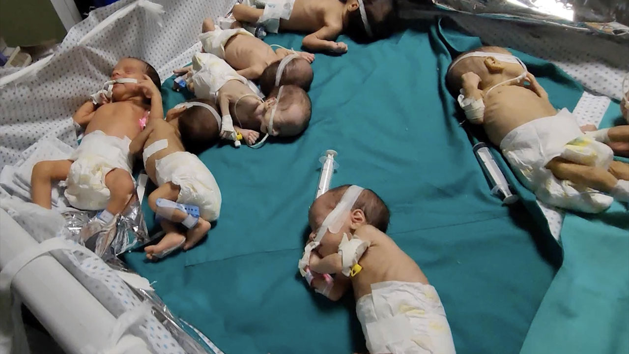 Kuşatılan Şifa Hastanesi'nde 4'ü prematüre bebek olmak üzere 51 hasta öldü