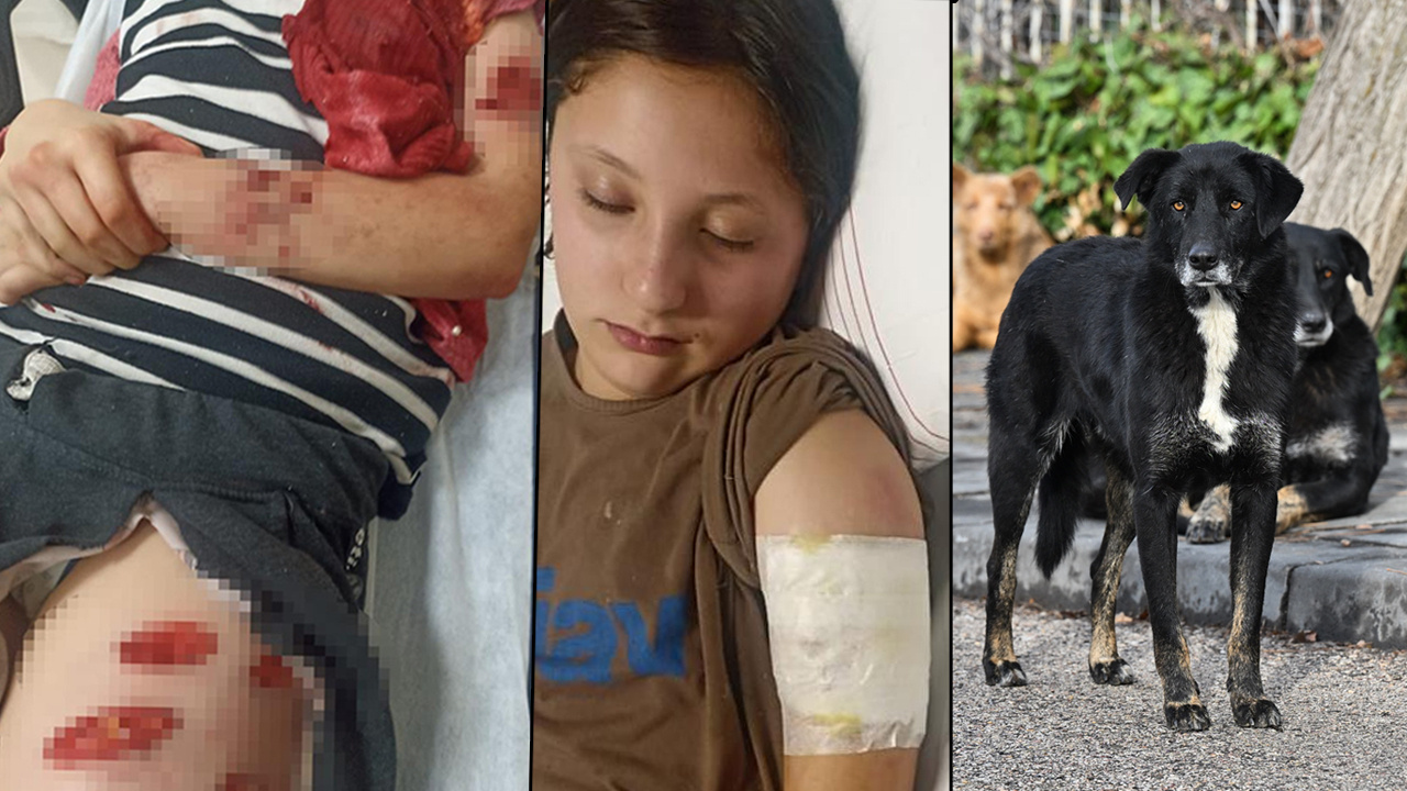 Şanlıurfa'da sokak köpeği saldırısı! Kız çocuğunu resmen parçalamışlar