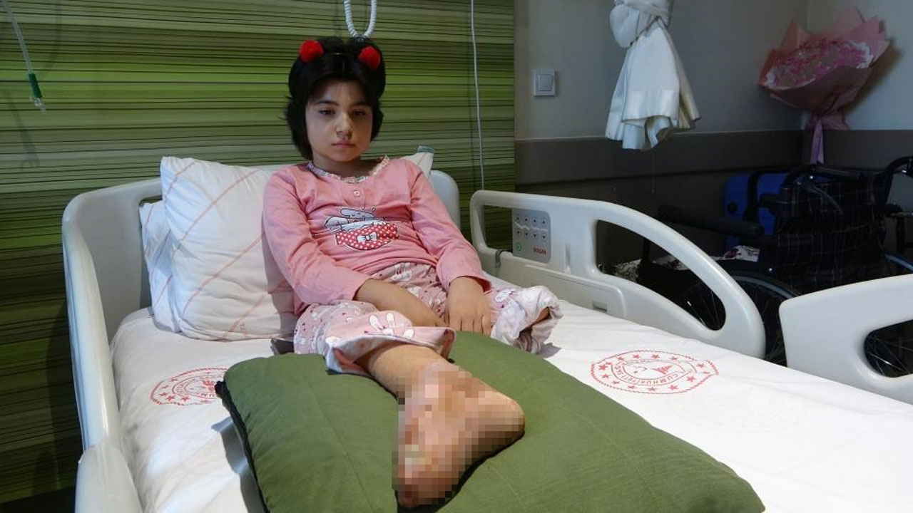 Depremden 3 gün sonra çıkarıldı sol bacağı kesildi sağ bacağı çürüyor 1 yıldır hastanede