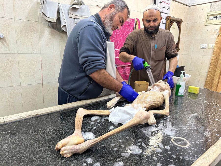 Gazze'de yetersiz beslenme sonucu ölen Filistinli çocuktan geriye bir deri bir kemik fotoğrafları kaldı