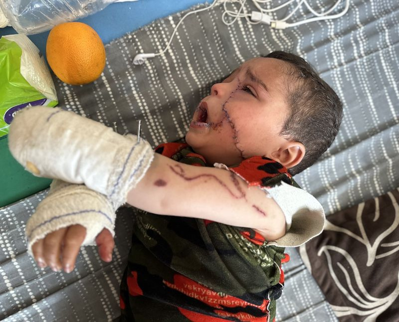 İsrail saldırısında ağır yaralanan Filistinli bebek, yaşam mücadelesi veriyor