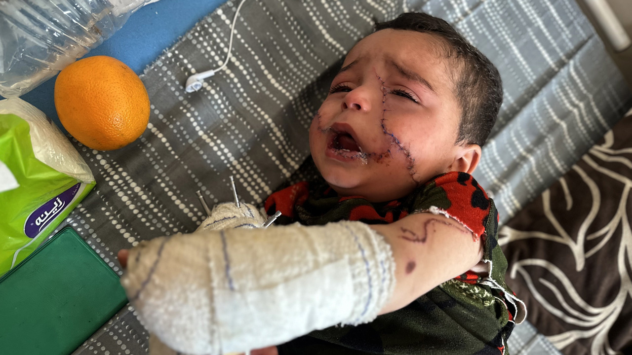 İsrail saldırısında ağır yaralanan Filistinli bebek, yaşam mücadelesi veriyor