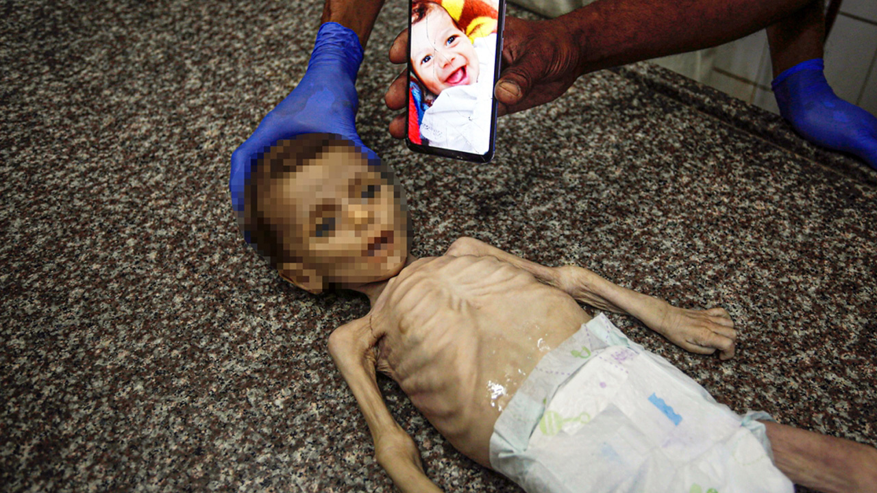 Gazze'de vicdanları sızlatan görüntü! 7 aylık bebek, yetersiz beslenme nedeniyle yaşamını yitirdi