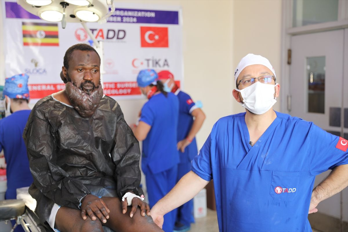 Sakal gibi uzayan 'keloid' şaşkına çevirdi! Ugandalı Muhammed'i Türk doktorlar kurtardı